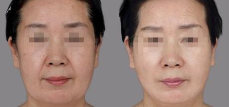 ?？谀募裔t(yī)院做微創(chuàng)好？全面解析?？谖?chuàng)手術技術領先的醫(yī)院