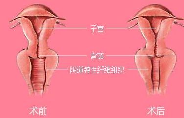長沙靠譜矯正醫(yī)院哪家好？解答你所有的疑慮！