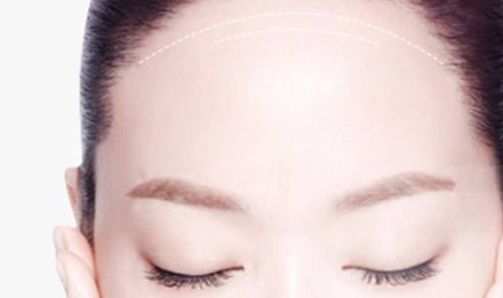 南京做修復(fù)雙眼皮哪家好？解析南京修復(fù)雙眼皮的最佳選擇