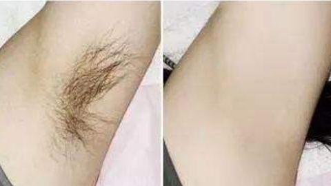 杭州藝星徐利剛醫(yī)生隆鼻項目靠譜嗎？技術(shù)操作曝光，口碑如何？