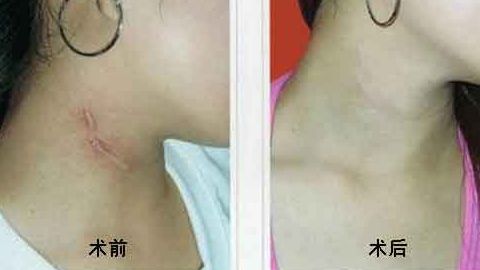 上海中西醫(yī)結(jié)合醫(yī)院整形美容科靠譜嗎？聽說口碑不錯(cuò)！