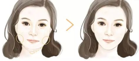 上海哪家下頜骨醫(yī)院好？解析上海下頜骨疾病常見(jiàn)病例及專業(yè)治療！