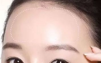 蘇州哪家黃褐斑醫(yī)院好？專業(yè)醫(yī)生推薦，讓你告別黃褐斑困擾！