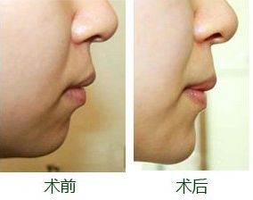 南寧整形豐胸醫(yī)院排名及評價(jià)互動(dòng)：哪家醫(yī)院效果更好？