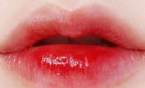 南寧祛疤整形哪家醫(yī)院最專業(yè)最受好評？