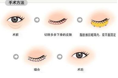 南寧治療痘印哪家醫(yī)院靠譜？—用戶首選南寧去痘印醫(yī)院排行榜