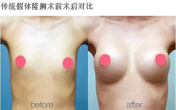 溫州雍禾醫(yī)院信譽(yù)如何？求推薦占家佳醫(yī)生植發(fā)效果如何？或溫州雍禾醫(yī)院口碑怎么樣？哪位醫(yī)生適合占家佳植發(fā)