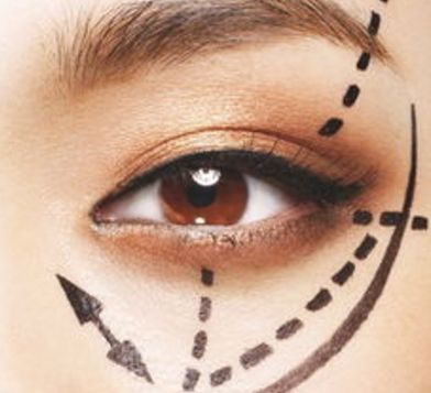 蘭州眼睛美容醫(yī)院哪家好？揭秘蘭州市最受歡迎的眼睛美容醫(yī)院排行榜！