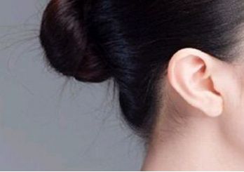 鄭州趙麗做雙眼皮修復效果如何？整形醫(yī)生背景和坐診情況請看！