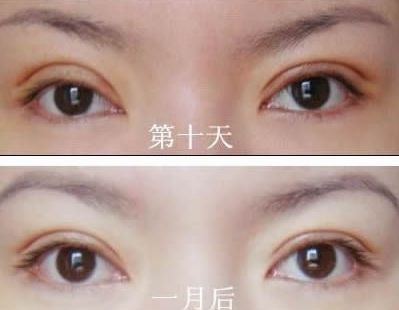 長春哪家醫(yī)院治痘痘好？了解長春市治療青春痘的專科醫(yī)院及價(jià)格