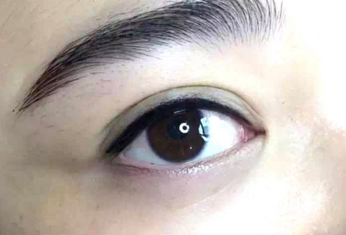 廣州金孝憲鼻部整形效果圖示，值得一看的真實(shí)案例！