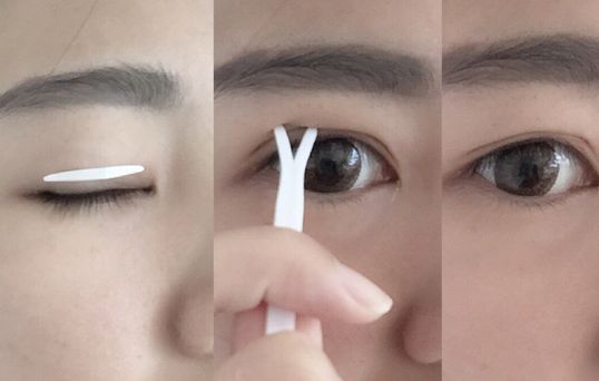2023寧波除皺紋針評(píng)分前十名醫(yī)生(張利杰、胡繼來(lái)、任森洋口碑人氣都可)