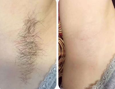 上海整形醫(yī)院哪家的好？最權(quán)威的排名榜單來幫你挑選！
