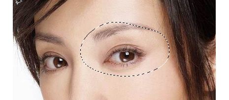 成都米蘭柏羽盧尚兵雙眼皮是否有效？美杜莎美眼術(shù)技術(shù)真如傳說中那么神奇？