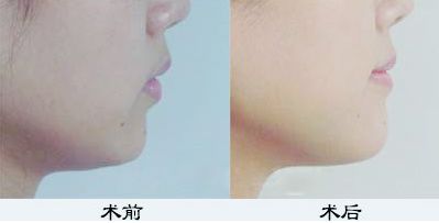 鄭州鼻綜合哪家醫(yī)院好？TOP醫(yī)療機構大揭秘