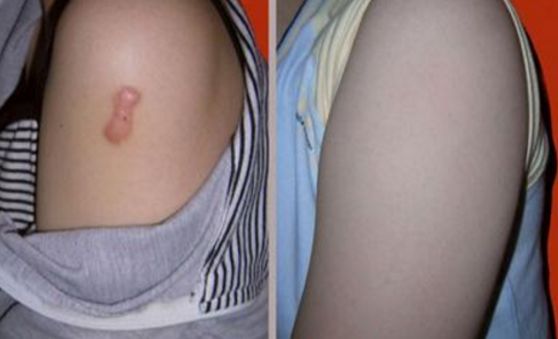 上海雙眼皮切開手術(shù)，哪家醫(yī)院技術(shù)好且安全？