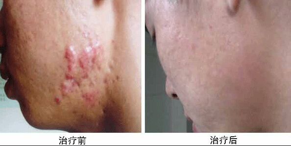 南京哪家醫(yī)院做兔唇手術效果好又安全？