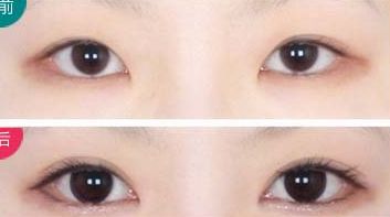 西安治療瘢痕哪家醫(yī)院好評(píng)不斷！