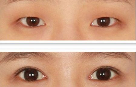 北京整容科好的醫(yī)院有哪些？中關(guān)村整形醫(yī)院綜合實力領(lǐng)先！