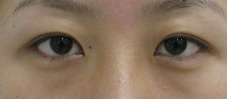 南寧哪家美容整形醫(yī)院口碑好又實(shí)惠？