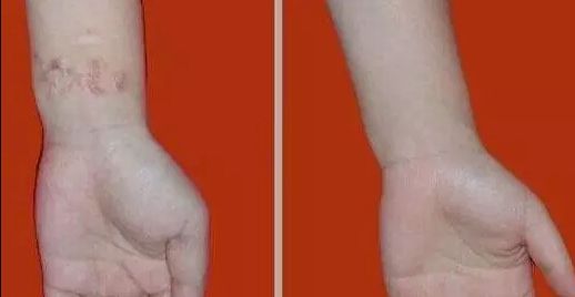 杭州哪家醫(yī)院看喉嚨好？排名最好的專業(yè)醫(yī)院推薦