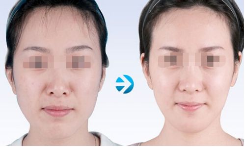 云南雙眼皮手術有哪些優(yōu)質(zhì)醫(yī)院值得推薦？