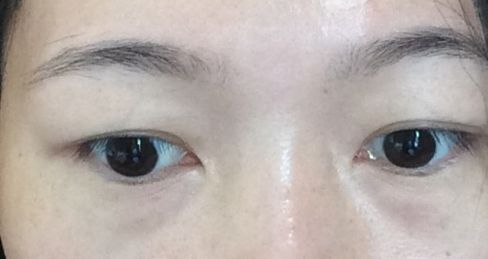 杭州祛雀斑哪家醫(yī)院好？選擇最適合您需求的專業(yè)祛雀斑醫(yī)院