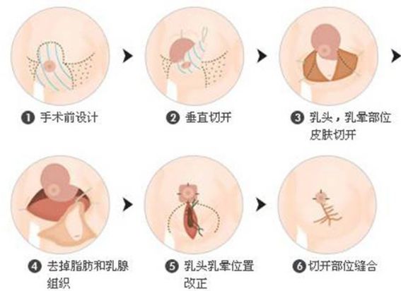 保定的整形醫(yī)院哪家好？全面解析保定整形醫(yī)院排名、口碑、專業(yè)團(tuán)隊(duì)等