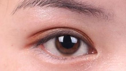 蘇州雙眼皮修復(fù)醫(yī)院排名及口碑，哪家醫(yī)院修復(fù)效果最好？