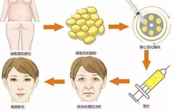 重慶整形磨骨哪家醫(yī)院好？整形醫(yī)院排行榜解讀，選擇最適合您的醫(yī)院！