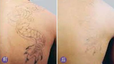 無錫哪家醫(yī)院眼科專業(yè)好？