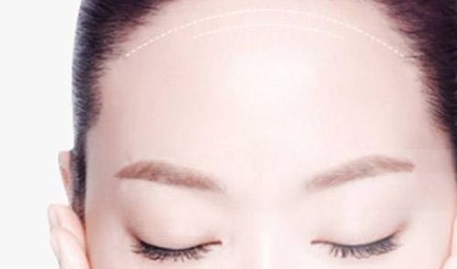 深圳哪家醫(yī)院的皮秒激光手術效果好？
