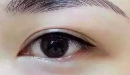 上海武警醫(yī)院割雙眼皮的手術(shù)費(fèi)用是多少？有哪些坐診醫(yī)生可以介紹？