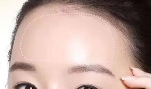 常州治療脫發(fā)哪家醫(yī)院靠譜？