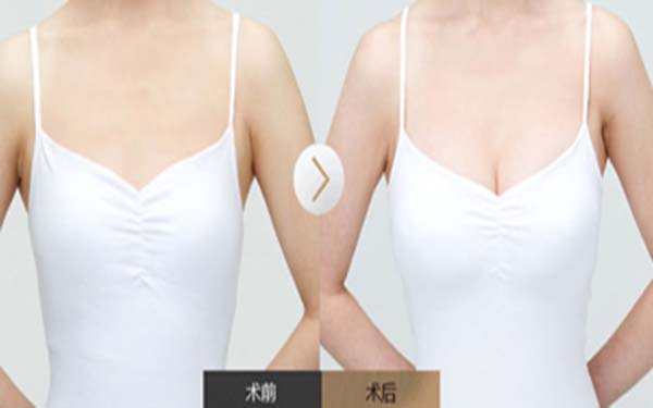 浙江同德醫(yī)院整形醫(yī)生名單、整形案例圖，為大家呈現(xiàn)