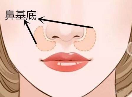 北京大學(xué)深圳醫(yī)院雙眼皮手術(shù)，何君君醫(yī)生口碑如何？資料公開！