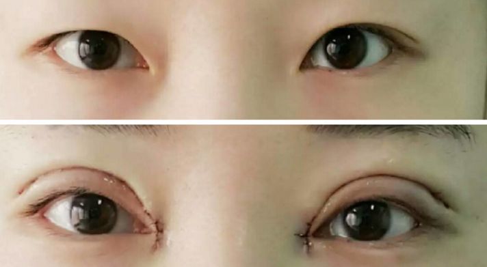 貴陽哪家醫(yī)院熱瑪吉效果好，值得推薦？