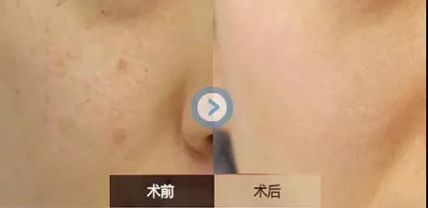 2023沈陽美膚祛斑專家上榜名單前10(敖彩虹、黎寶川、王志濤實力與口碑滿分！)