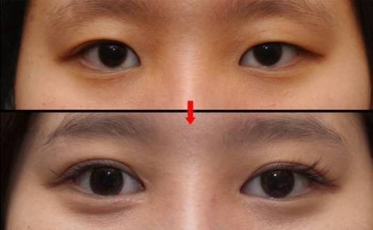 2023佛山大腿吸脂瘦腿專家評(píng)分前10強(qiáng)(謝漢平、曹碧浪、佛山曙光金子劉云忠龍頭地位穩(wěn)固)