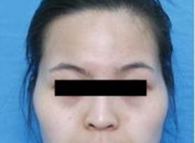 成都治療臉上痘痘哪家醫(yī)院好？專家推薦的成都治痘好醫(yī)院大揭秘！
