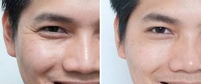 南京哪家整形醫(yī)院隆鼻效果最好？