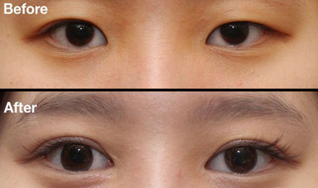 昆明刀疤修復(fù)哪家醫(yī)院好？挑選昆明專業(yè)刀疤修復(fù)醫(yī)院的技巧與要點(diǎn)
