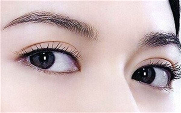 如何選擇北京雙眼皮埋線哪家好？細(xì)致評級幫您快速決策！