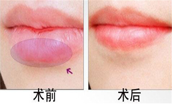 2023常德平滑吸脂瘦身評(píng)分十強(qiáng)醫(yī)生(陳勇、肖世錦、李進(jìn)進(jìn)這些專家口碑靠前)