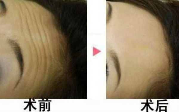 揭秘北京隆鼻領(lǐng)域的專家陳育哲、連凱峰等五位口碑扎實(shí)的權(quán)威專家