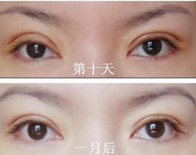 2023洛陽額頭打除皺針在榜單前十位醫(yī)生(劉戰(zhàn)輝、黃浩浩、周先華手法嫻熟自然)