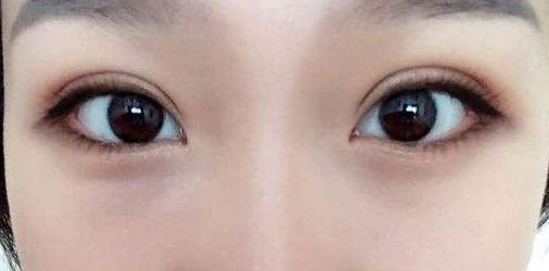 永州地區(qū)哪家正規(guī)整形醫(yī)院好？