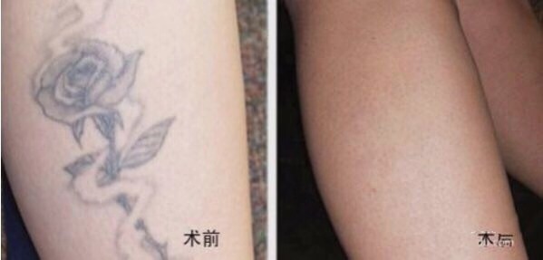 不二選擇！上海鼻修復(fù)專家徐永豐、劉仁輝搶占熱門名單成功！個(gè)人實(shí)力攀升不可阻擋！