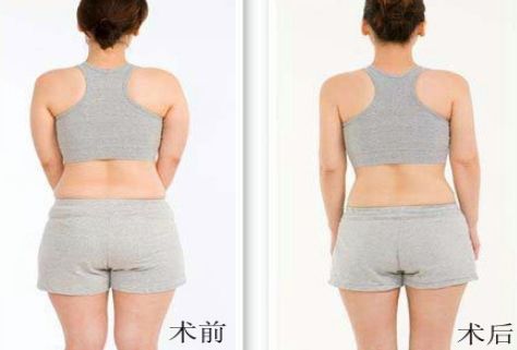 杭州哪家祛痘醫(yī)院好？綜合評(píng)測(cè)幫你選擇！