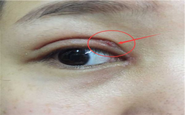 蘇州隆胸哪家醫(yī)院好？專業(yè)醫(yī)師為您分析